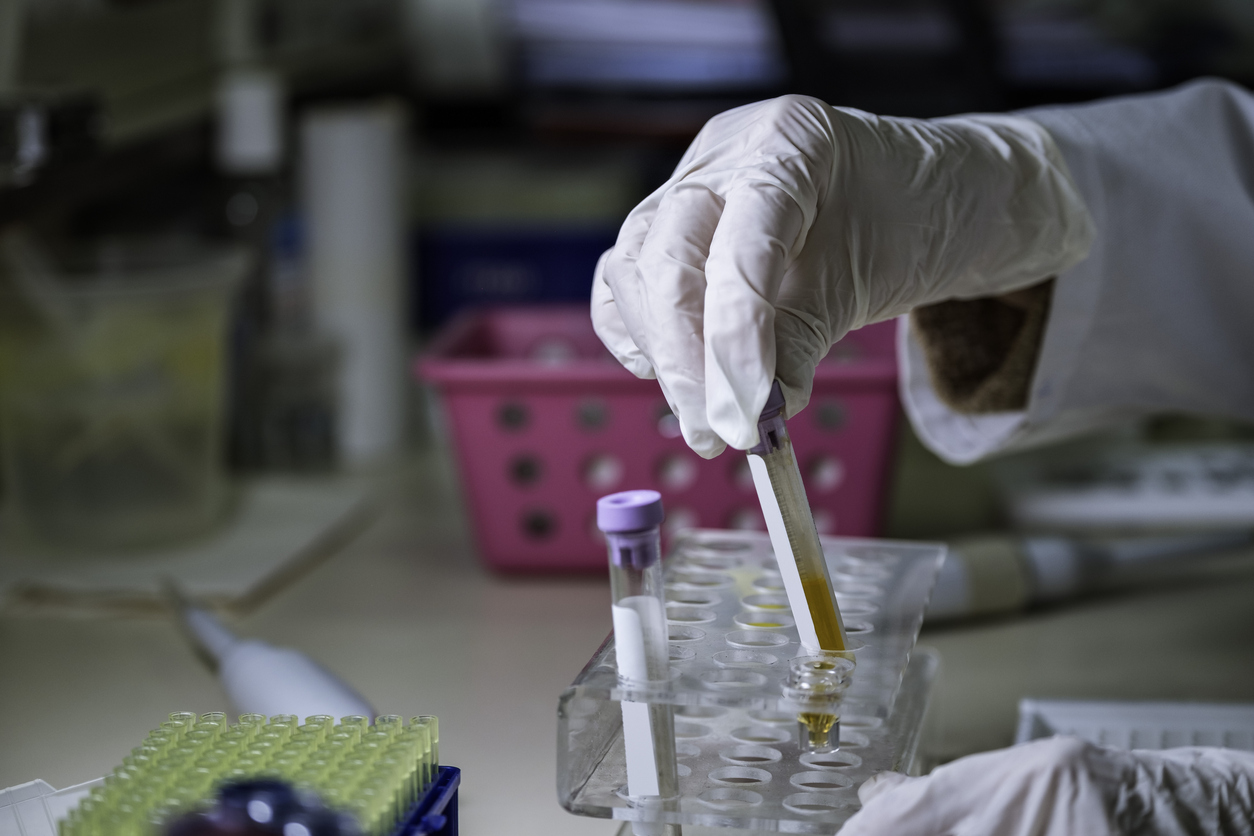 Are You Suspended After A Urine Test?